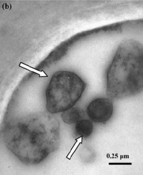 Flavescence dorée